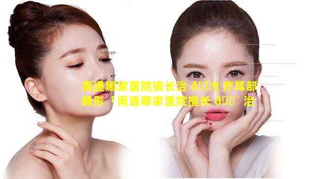 南通哪家医院擅长治 🐶 疗耳部畸形「南通哪家医院擅长 🌴 治疗耳部畸形最好」